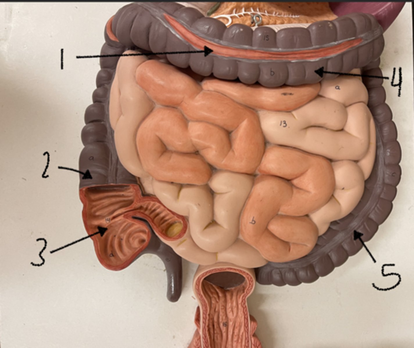 <p>what is structure 2</p>