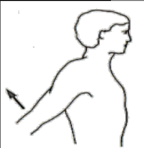 <p>What Movement is occurring?</p>