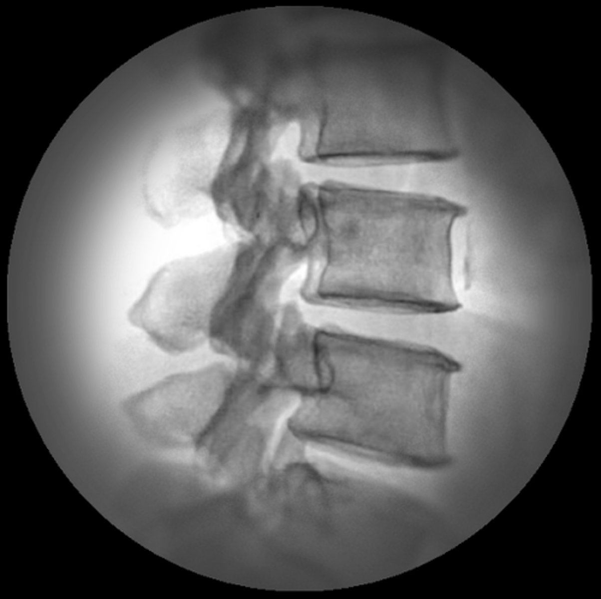 <p>a. Vignetting</p>