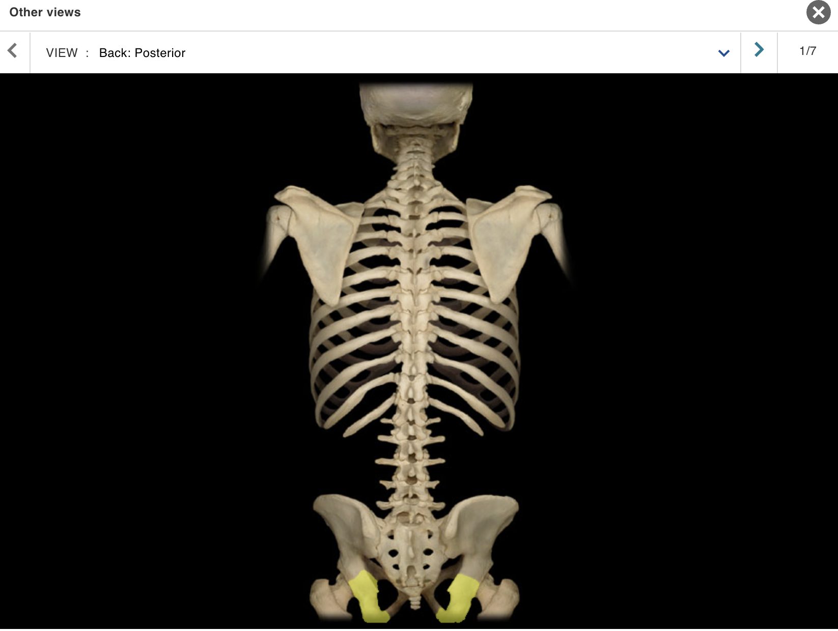 <p>Location:</p><p class="p1">• Pelvis</p><p class="p1">Description:</p><ul><li><p>﻿﻿One of three coxal (hip) bones</p></li><li><p>﻿﻿Characteristic features include tuberosity and spine</p></li><li><p>﻿﻿Contributes to acetabulum (hip joint socket), obturator foramen, and wall of lesser (true) pelvis</p></li></ul><p>Comment:</p><ul><li><p>﻿﻿Fused with ilium and pubis in adult to form coxal (hip) bone</p></li><li><p>﻿﻿Bony pelvis formed by paired hip bones and sacrum</p></li><li><p>﻿﻿Obturator foramen formed by rami of pubis and ischium</p></li></ul><p></p>