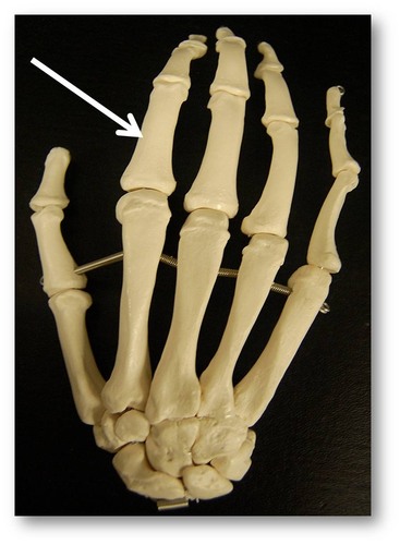 Name this specific bone.
