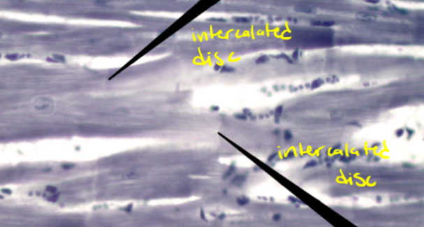 <p>Intercalated discs</p>
