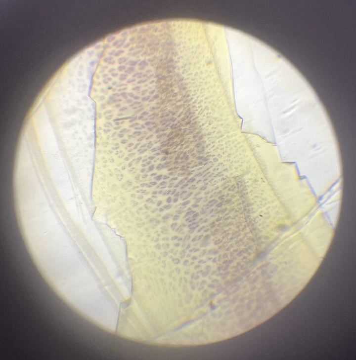 <p>Трахея </p>