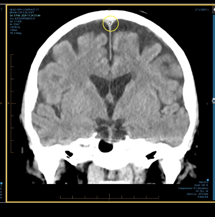 term image