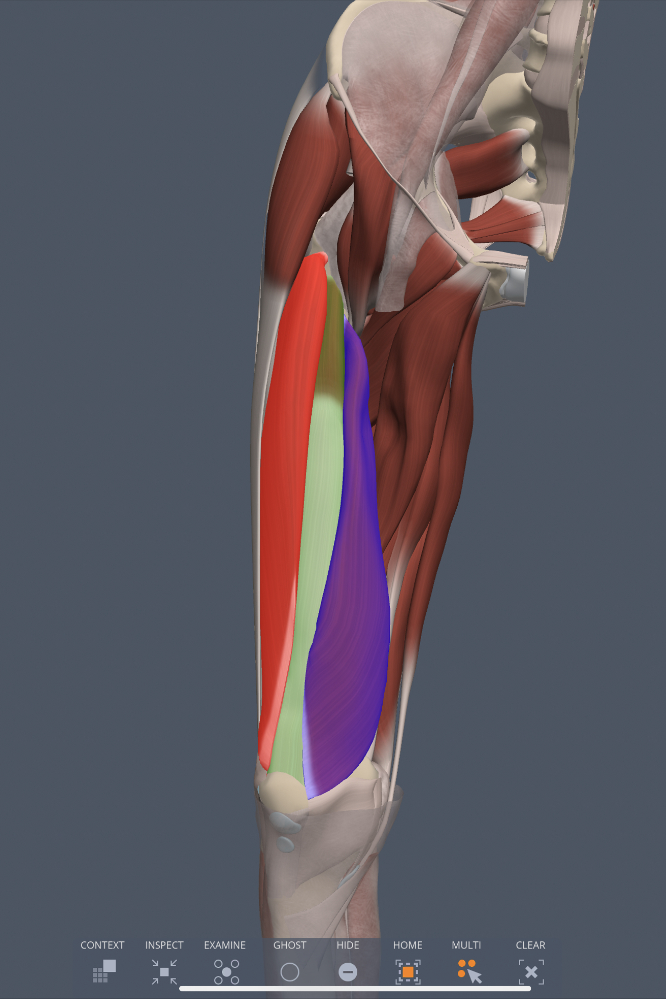 vastus medialis (anterior thigh) insertion
