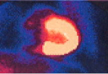 <p>What view of the heart is represented in this image?</p>