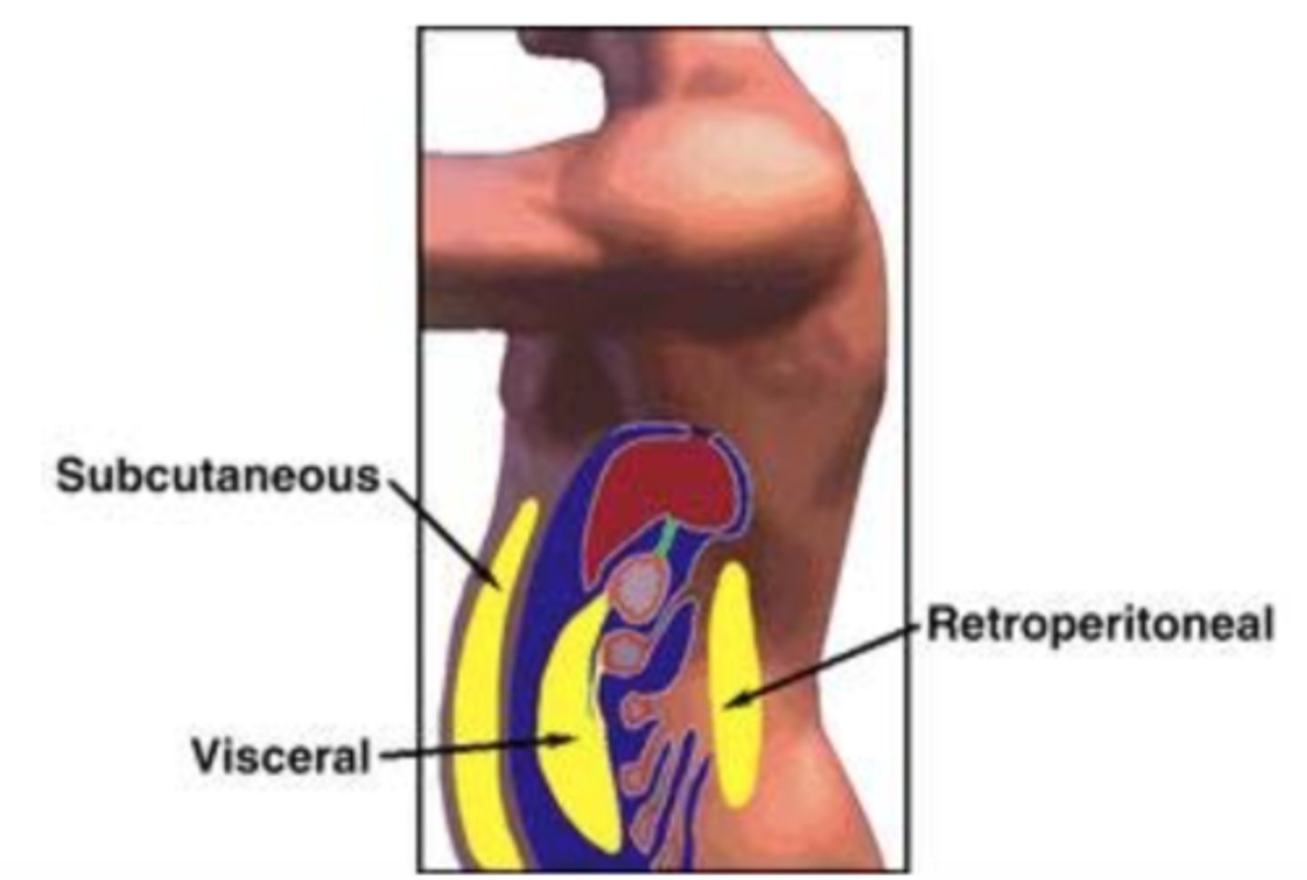 <p>visceral or central is located deep in the abdominal cavity and is more metabolically active</p><p>subcutanous or peripheral is located just beneath the skin commonly located in the lower extremities/buttocks</p>