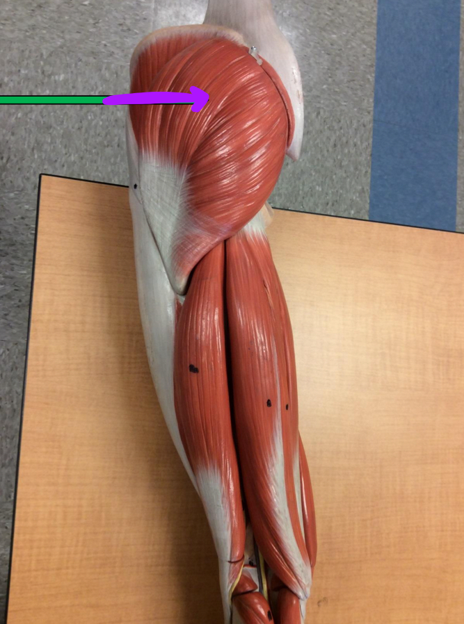 <p>Identify this muscle?</p>