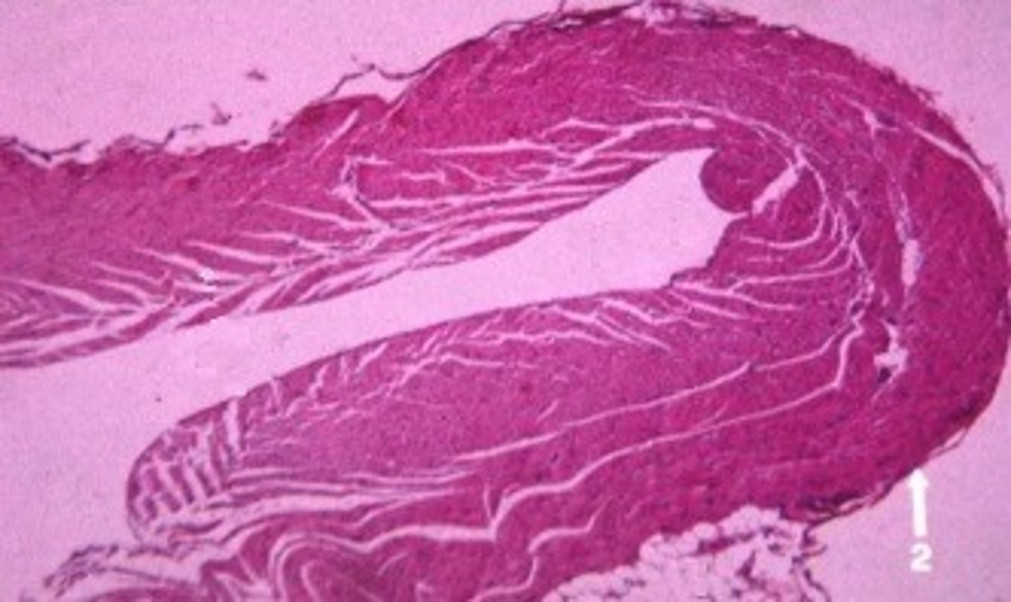 <p>Identify the tissue indicated by #2 and give a second name for the tissue.</p>