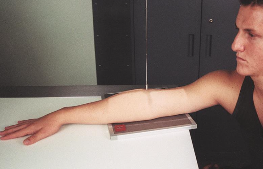 <p>internal/medial oblique (elbow)</p><ul><li><p>arm placed AP → palm is turned flat on table&nbsp;</p></li><li><p>elbow is 45°</p></li></ul><p></p>