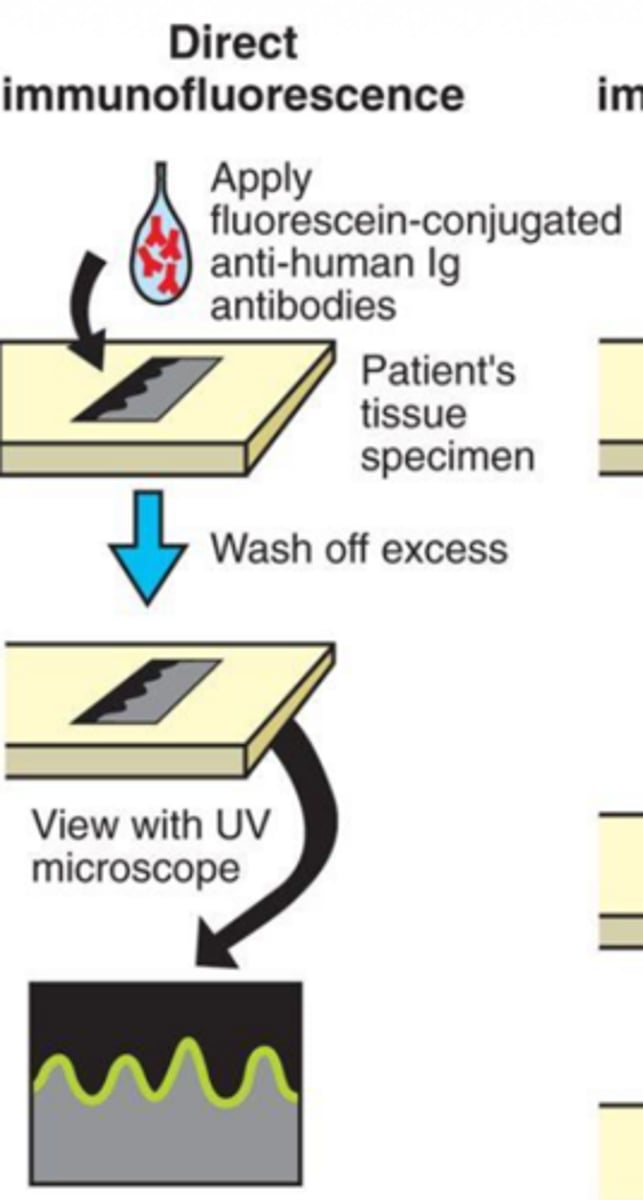 <p>using goat antibodies;</p><p>1. insert human antibodies into a goat</p><p>2. allow goat immune system to form antibodies against the human antibodies</p><p>3. remove goat antibodies from the goat and tag with a fluorescent dye</p><p>4. apply goat antibodies to a biopsied specimen and view under UV light</p>