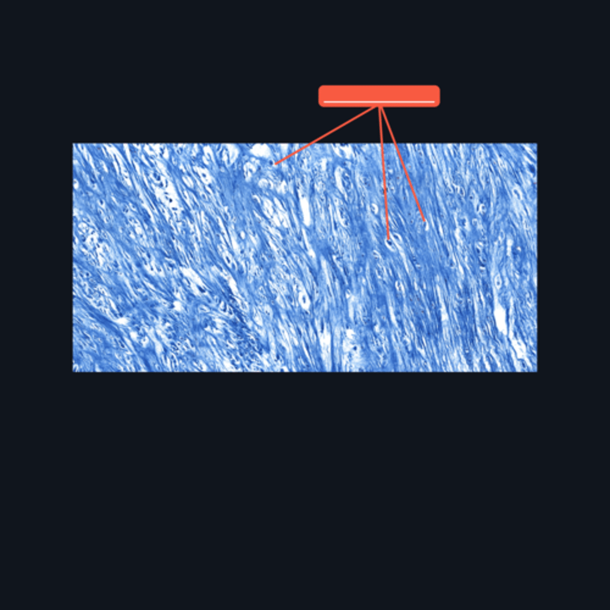 <p>This cartilage is commonly mistaken as _____. However, when examined closely, _____are contained in _____ (identify pointed structures), making it a cartilage.</p>