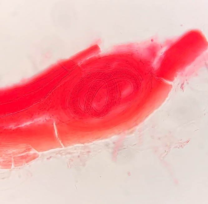 <p>Phylum?<br>Symmetry? Tissue type?<br>Cavity?<br><br>identity?</p>