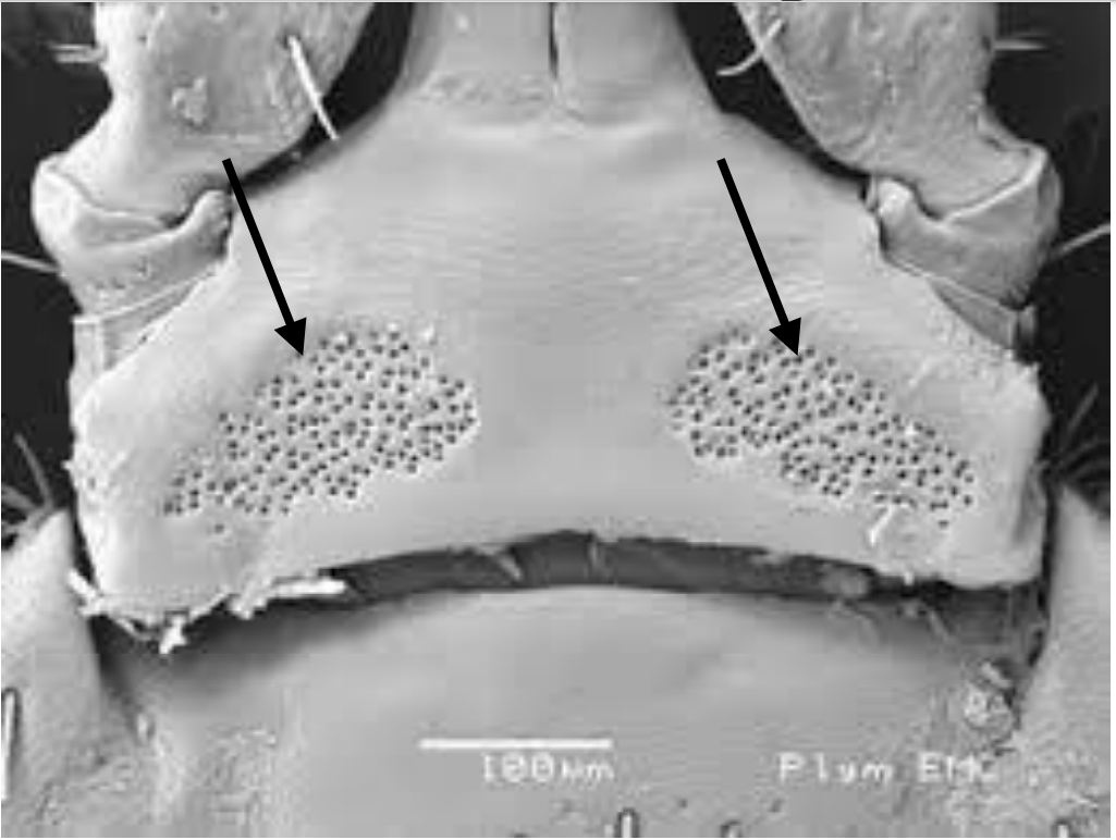 Identify the pointed structures