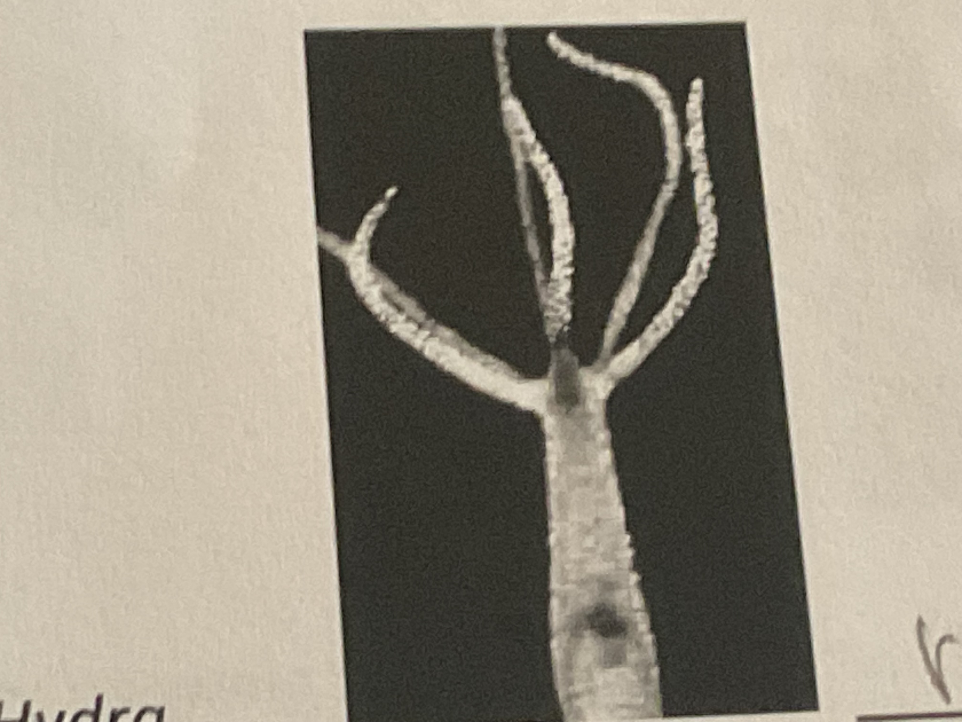 <p>What type do symmetry is hydra ? </p>