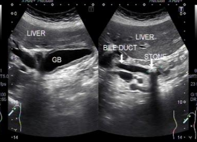 <p>Describe this image</p><p>Diagnosis?</p>