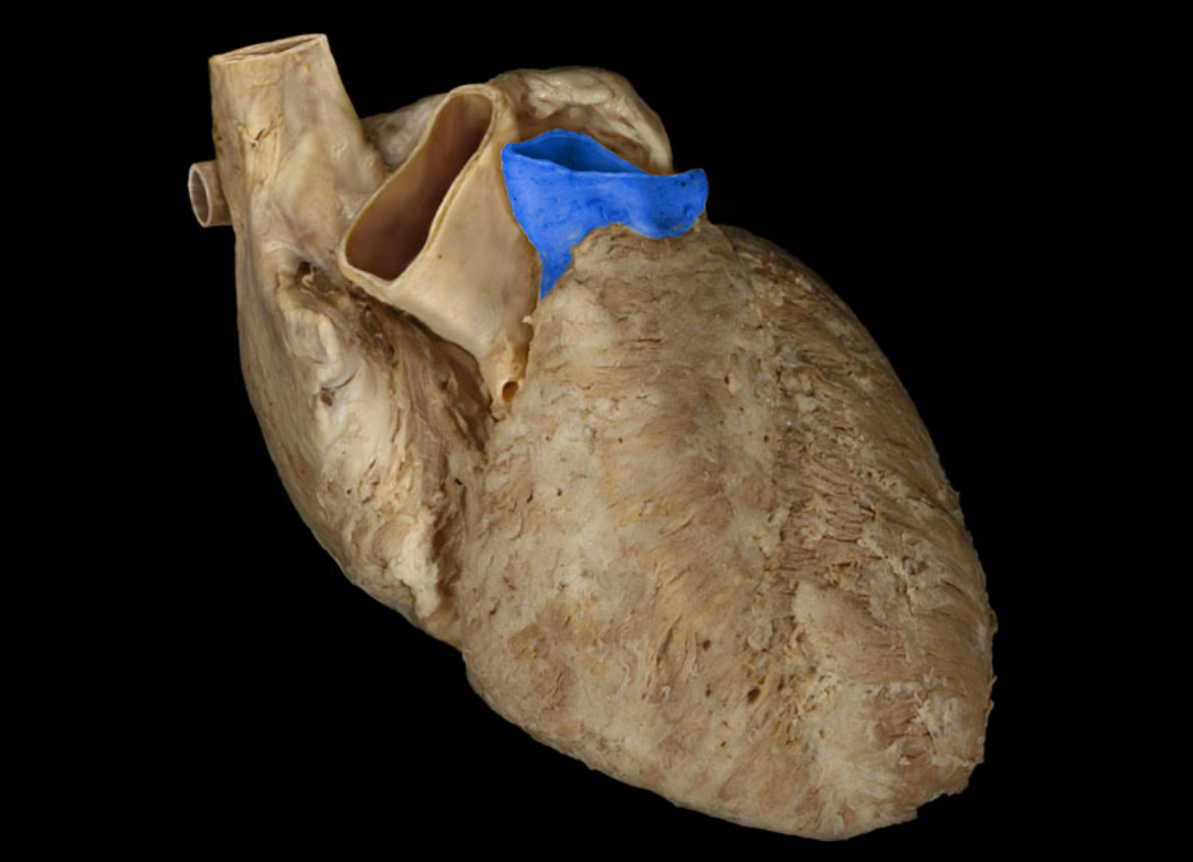 term image