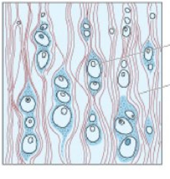 <ul><li><p><span>Tejido conectivo denso</span></p></li><li><p><span>Pequeñas regiones de matriz con lagunas </span></p></li><li><p><span>Condrocitos solos o en grupo, dispuestos en hileras</span></p></li><li><p><span>Sin pericondrio</span></p></li></ul>