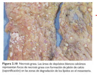 <p>-Áreas focales de destrucción de grasa, por liberación de lipasas pancreáticas activadas al interior del páncreas y la cavidad peritoneal. (En pancreatitis aguda) </p>