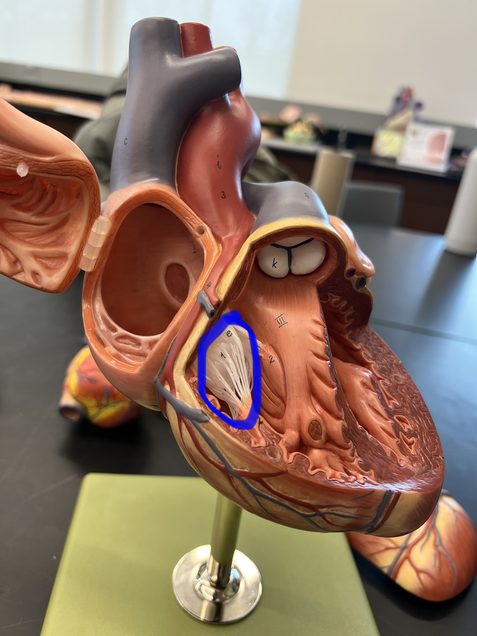 Name the heart structure.