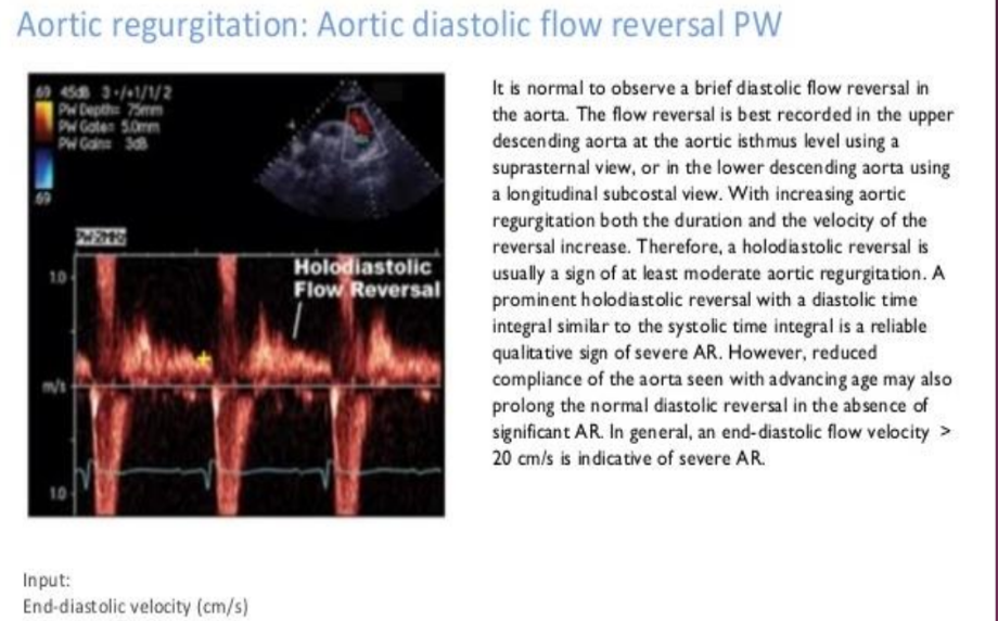 <p>In some patients with moderate AR as well as those with severe AR.</p>