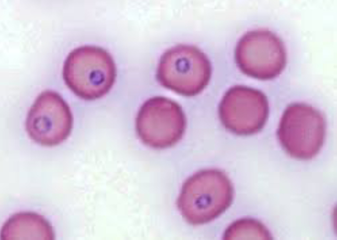 <p>Blood smear</p>