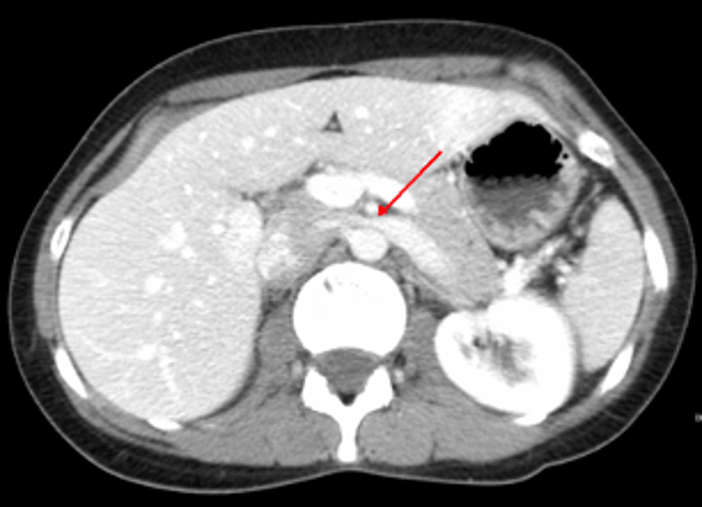 <p><em>identify the pathology</em></p>