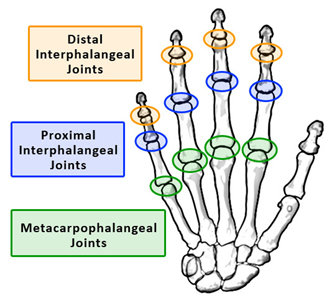 <ul><li><p><strong>metacarpophalangeal joints</strong> are condyloid joints (have a lot more range of motion, first knuckle)</p></li><li><p>flexion and extension (anterior and posterior movement respectively)</p></li></ul><p></p>