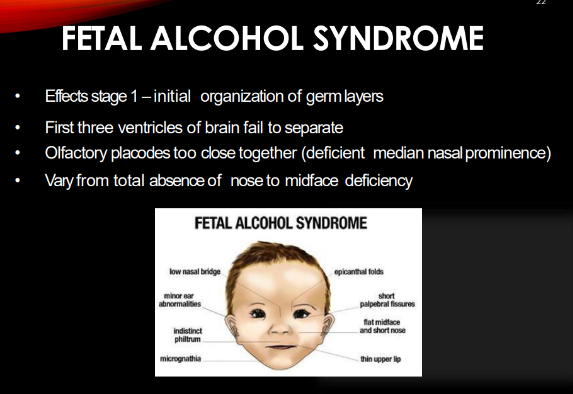 <p><strong>first 3 ventricles of brain do NOT separate</strong><br>“olfactory placodes” (tissue that’s important for sense of smell) are <u>too close </u>together → “deficient median nasal prominence” (nose/upper life form weirdly) <br>-vary from total<u> absence of nos</u>e to <u>midface deficiency</u></p>