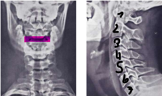 <p>Bezeichnung von </p><ul><li><p>vorne nach hinten</p></li><li><p>seitlich</p></li></ul><p></p>