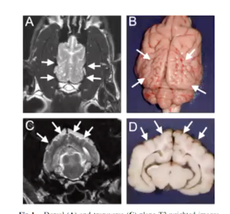 <p><strong>• Abnormal neuronal migration of brain neurons (specifically of abnormal cortical lamination) = excessive cortical folding</strong></p><ul><li><p>Resulting in increase in numbers of smaller irregularly convoluted cortical gyri</p></li></ul><p><strong>• Signs:</strong></p><ul><li><p>Blindness with or without other neurological deficits.</p></li></ul><p></p>