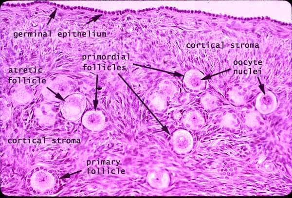 la _________ del ovario incluye:

* epitelio germinal
* tunica albuginea
* corteza ovarica
* medula ovarica
* foliculos ovaricos
* cuerpos luteos

\
\
