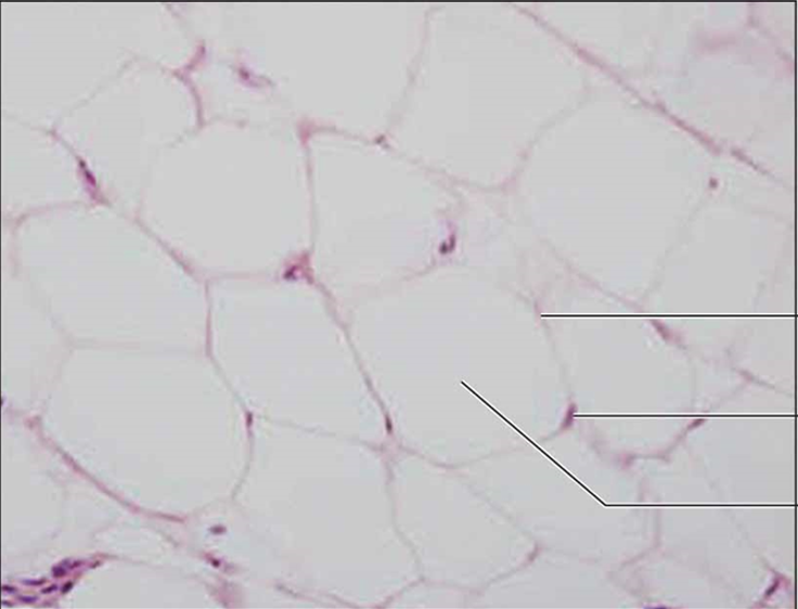 <p>adipose connective tissue</p>