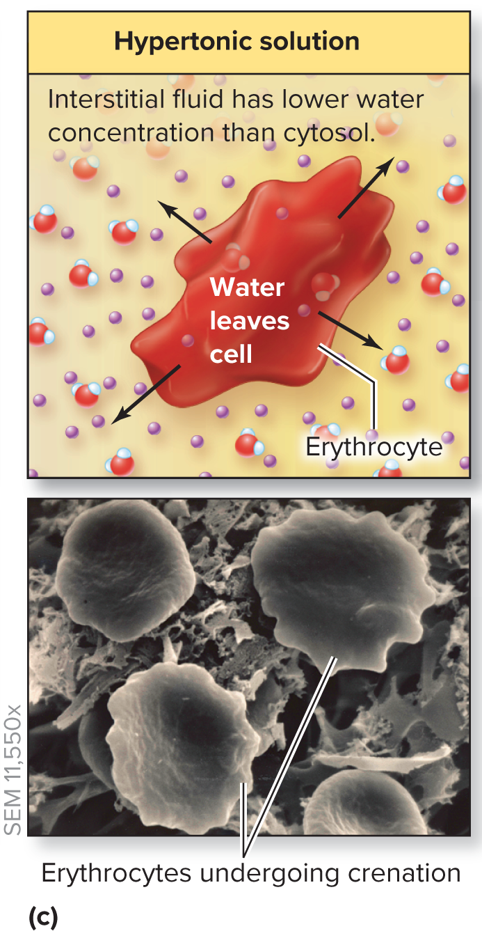 <p>Water leaves the cell → crenation (CELL SHRINKS)</p><p>In: LESS concertation</p><p>Out: MORE concentration </p>