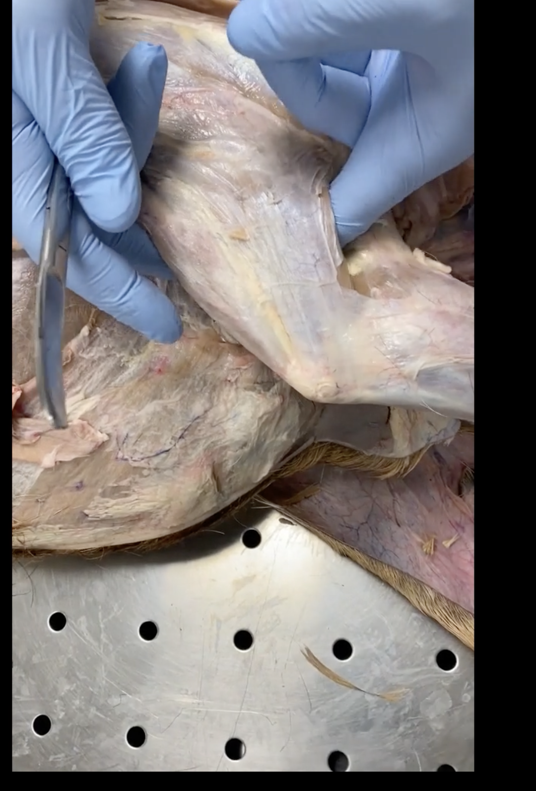<p>in thoracic limb</p>