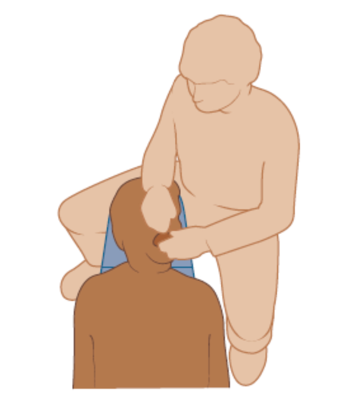 <p><strong>What clock position is this?</strong></p>