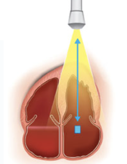 <p>alternates transmission and reception of ultrasound</p>