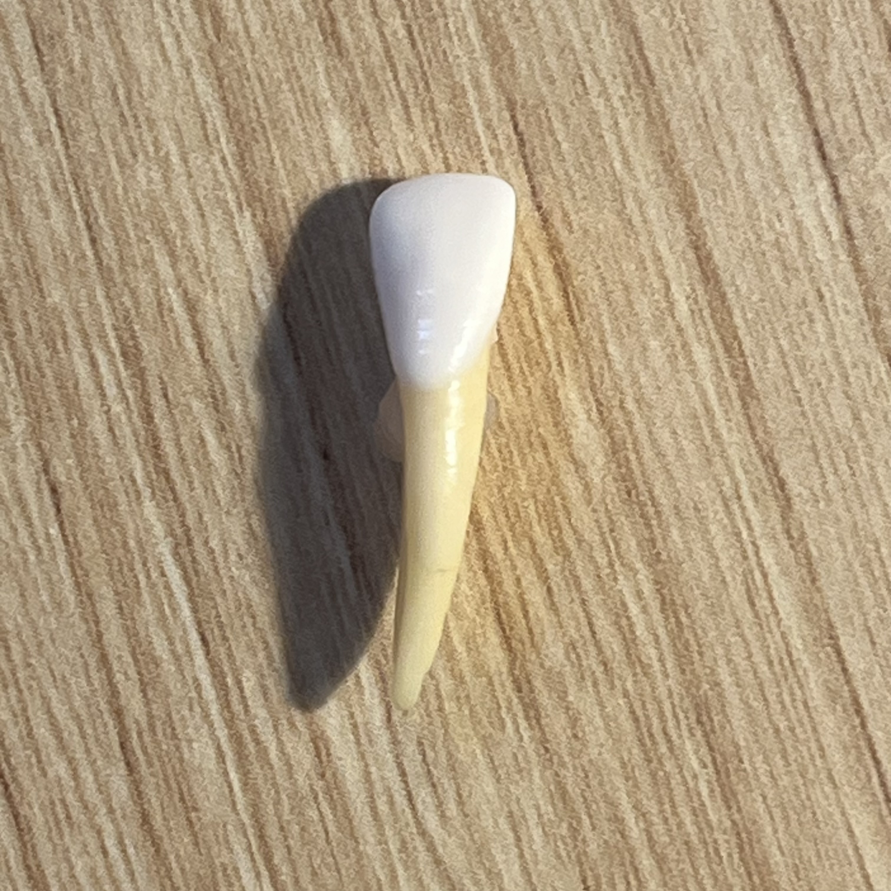<p>What tooth is this (with view)?</p>