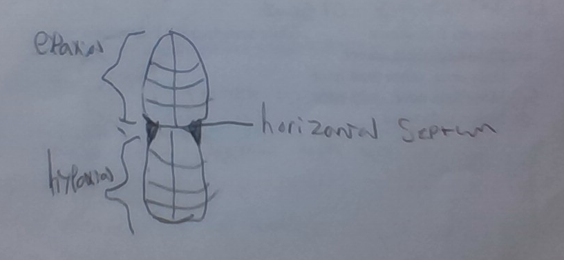 <p>Hypaxial muscles.</p>