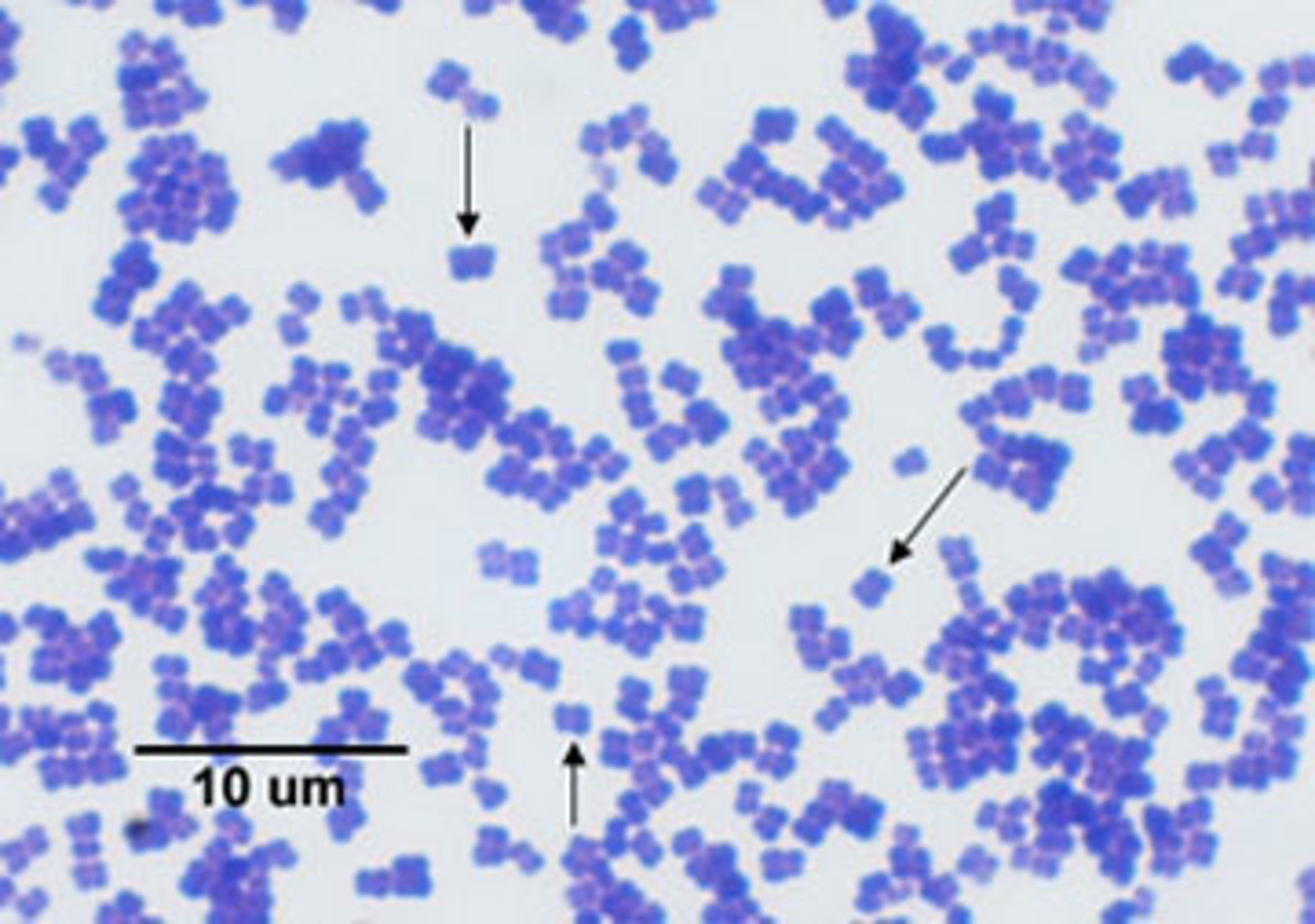 <p>What bacterial arrangement is pictured here?</p>