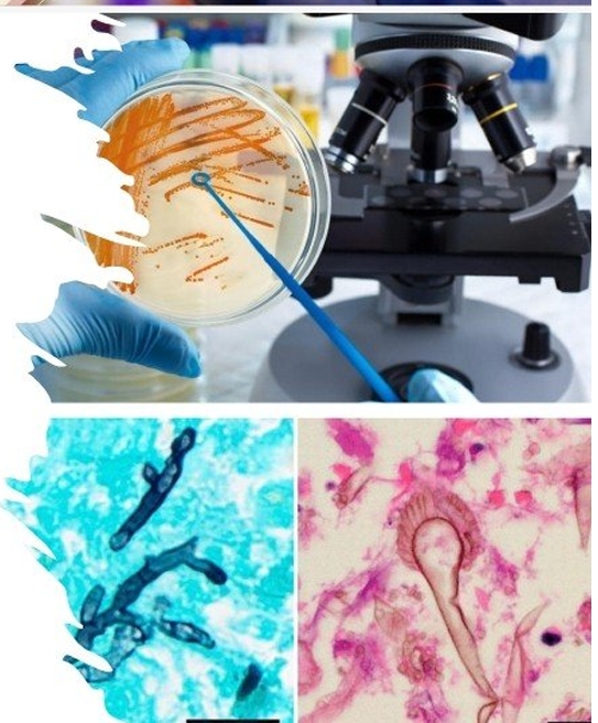 <p>what is the type of test ?</p><p>Examples ?</p><p></p>