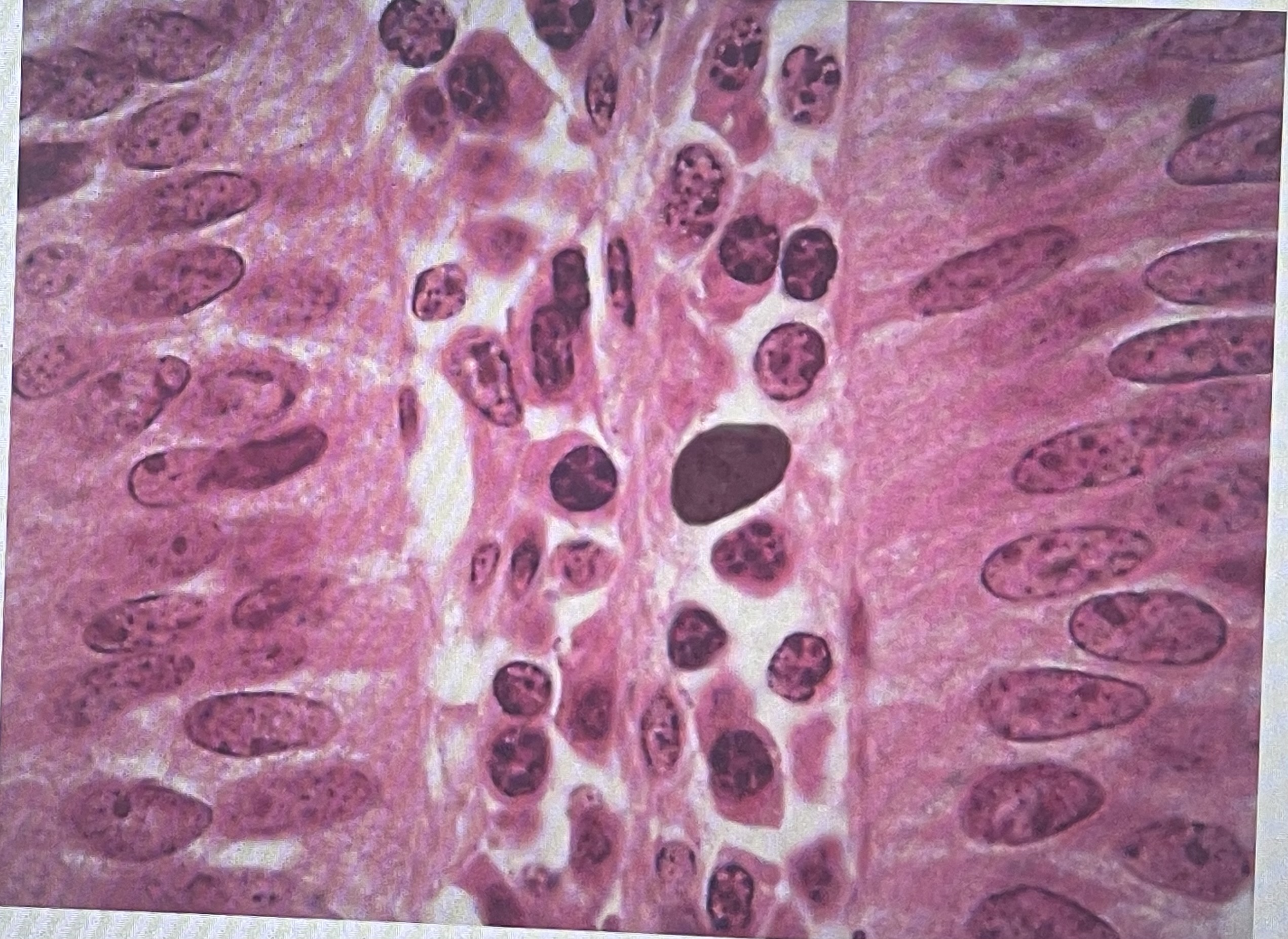 term image