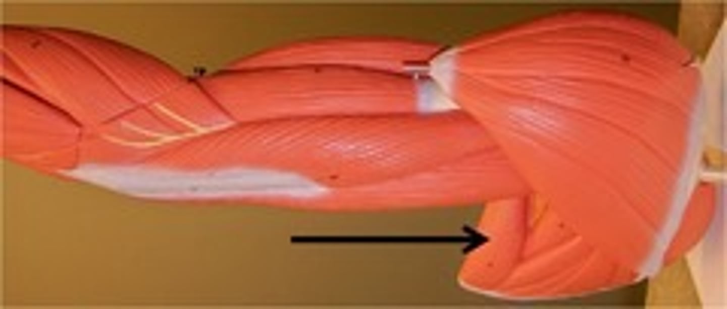 <p>What is indicated?</p>