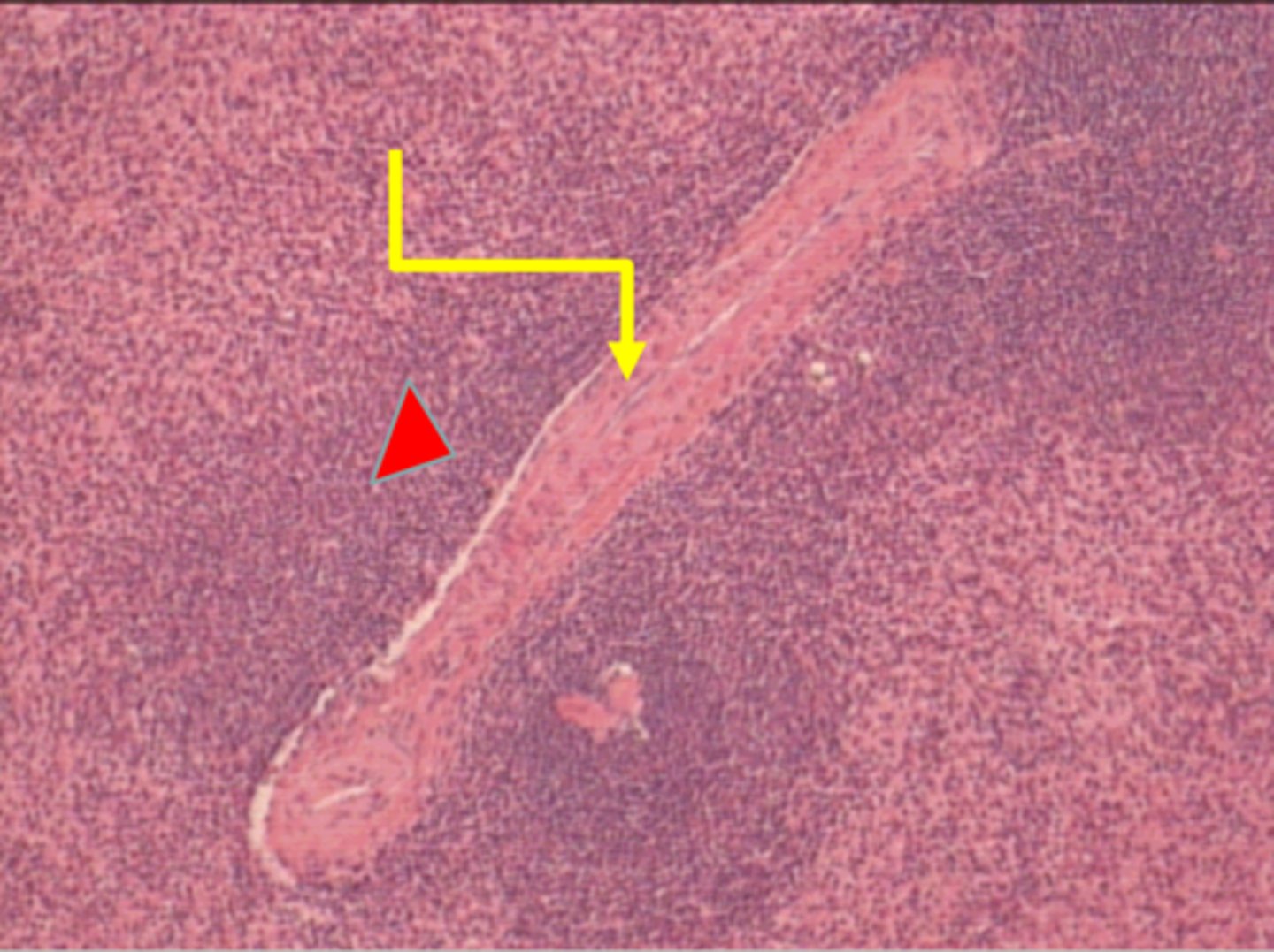 <p>yellow arrow</p><p>central artery</p>