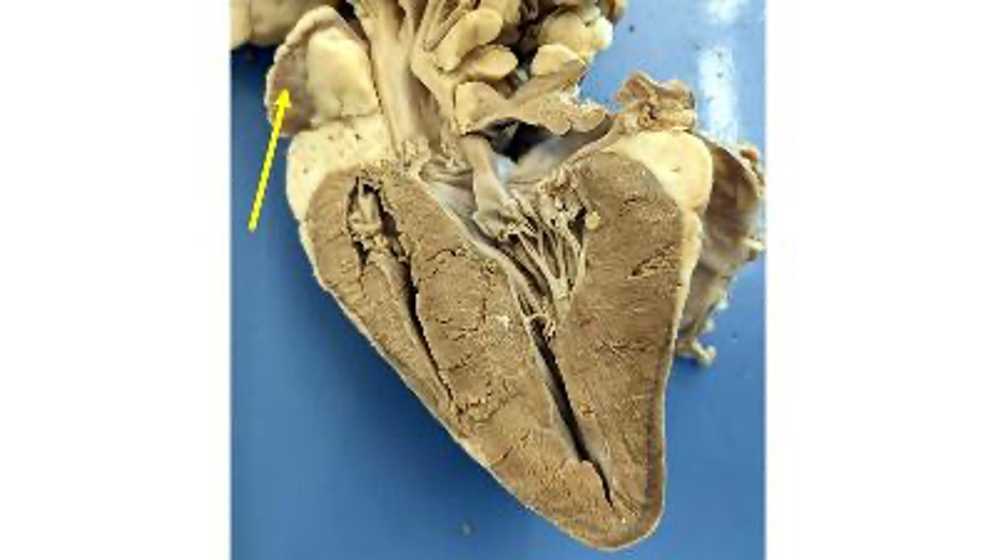 <p>Name the ear-like structure</p>
