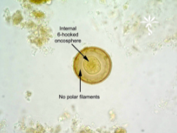<p>What is the genus, species, and stage of this parasite?</p><p>• 60-86μm</p><p>• Spherical and slightly yellowish</p><p>• No polar filament</p><p>• Oncosphere with 6 (3 pairs) of hooks</p>