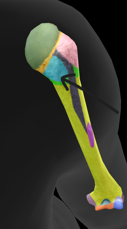 term image