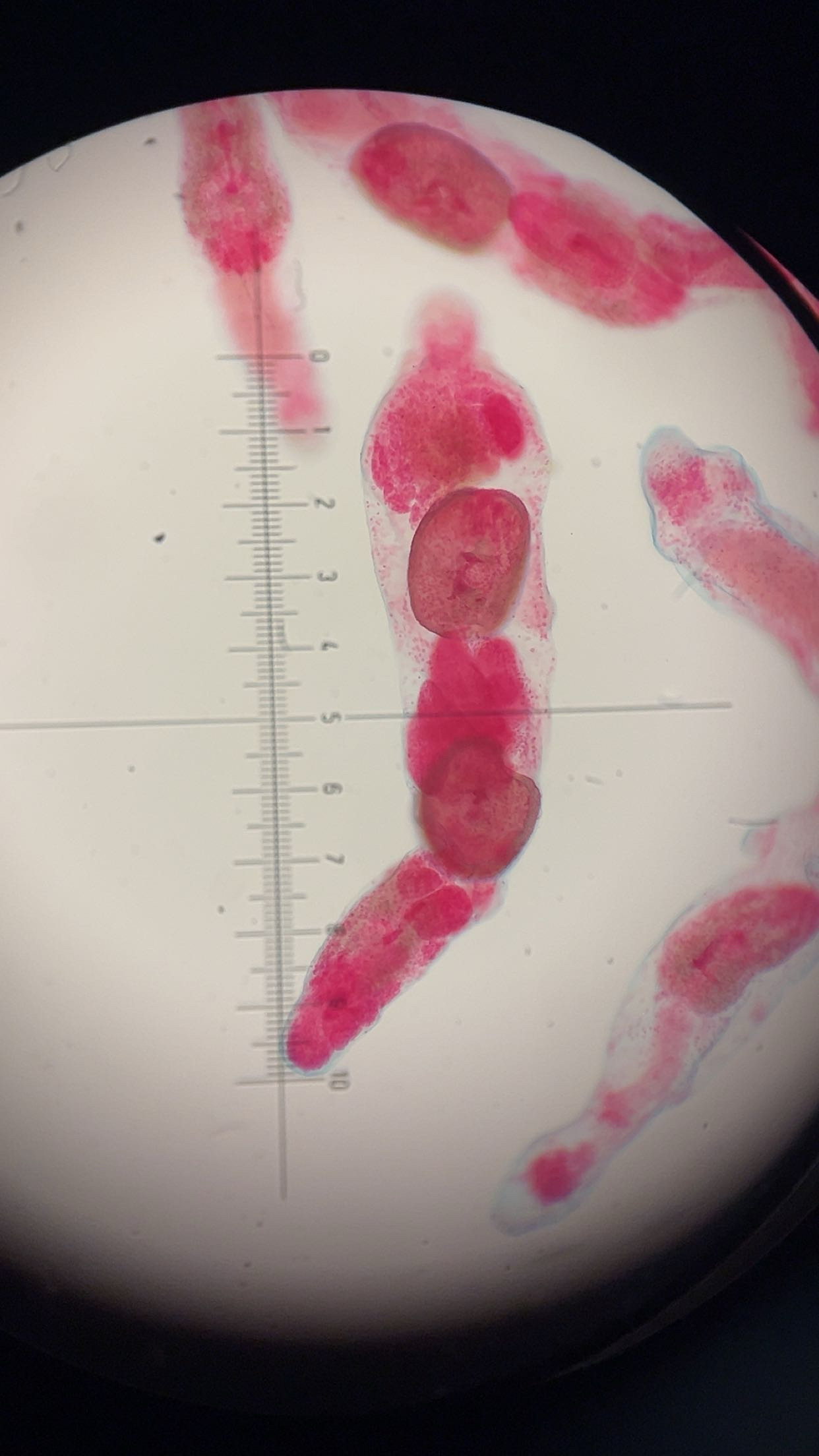 <p><em>Fasciola hepatica</em> redia</p>