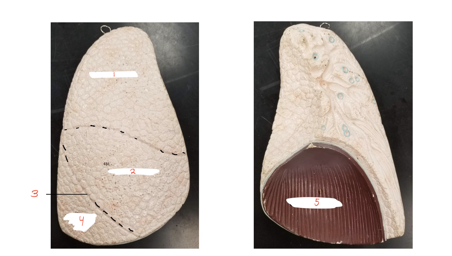 <p>what lung is this?</p>