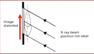 <p>image distorted </p>